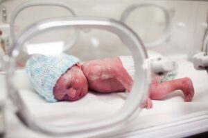 ماهي الولادة المبكرة؟ ماهي أعراضها وأسبابها؟ وكيفية العلاج والوقاية؟