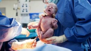 الفرق بين التخدير النصفي والكلي في الولادة القيصرية ، وأيهما أفضل؟