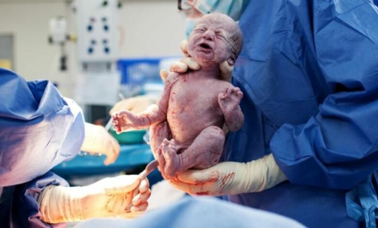 الفرق بين التخدير النصفي والكلي في الولادة القيصرية ، وأيهما أفضل؟