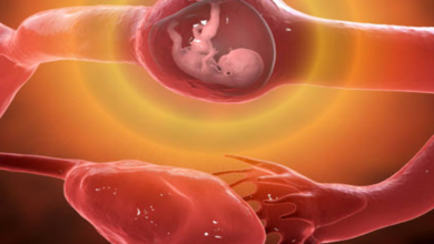 الحمل خارج الرحم : الاعراض ، الأسباب ، المضاعفات ، العلاج ، الوقاية منه